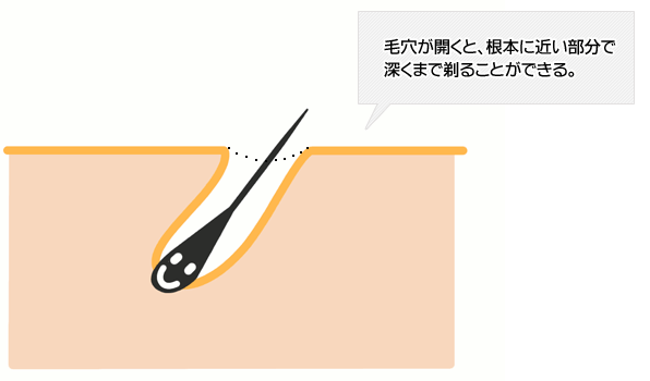 毛穴が開くイラスト