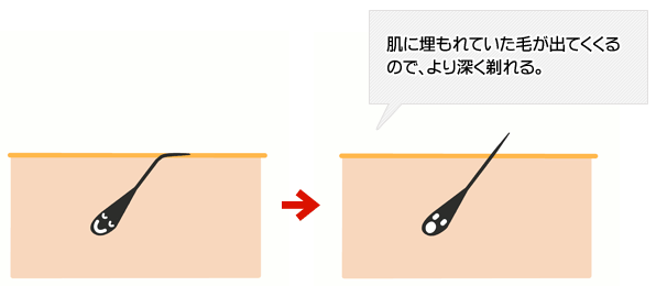 埋もれた毛を逆立てるイラスト